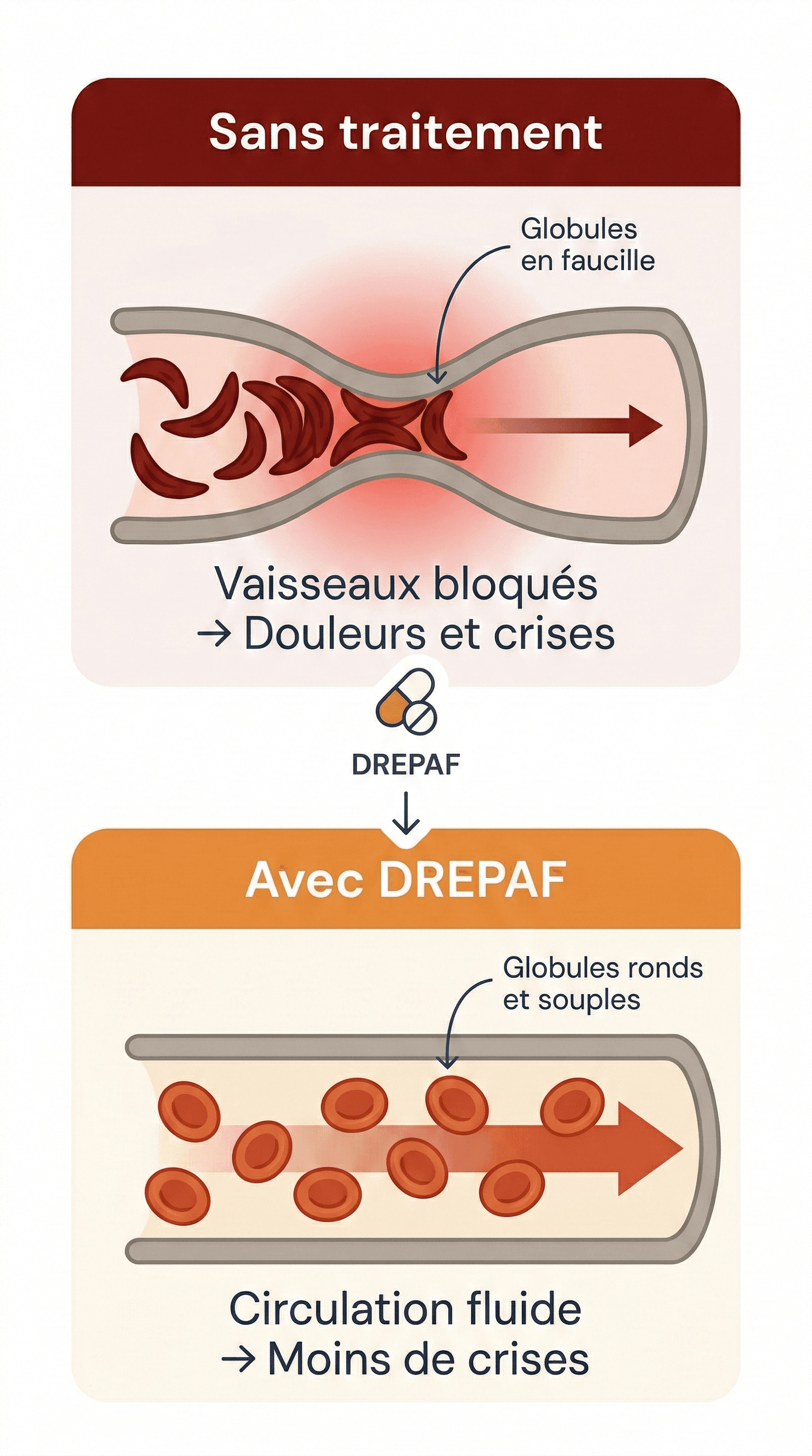 Schéma comparatif avant/après traitement DREPAF : sans traitement, les globules en faucille bloquent les vaisseaux causant douleurs et crises ; avec DREPAF, les globules ronds et souples circulent librement, réduisant les crises