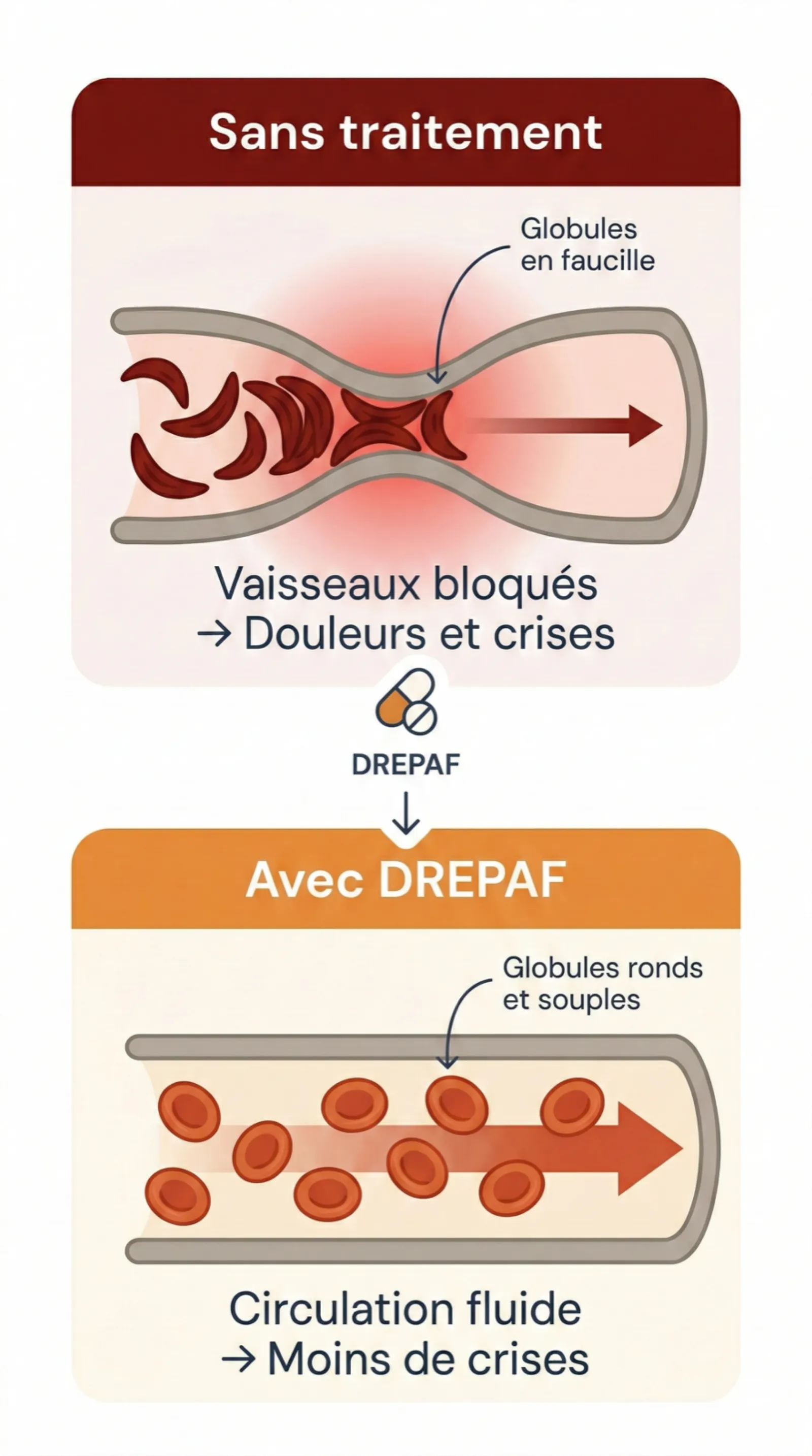 Schéma comparatif avant/après traitement DREPAF : sans traitement, les globules en faucille bloquent les vaisseaux causant douleurs et crises ; avec DREPAF, les globules ronds et souples circulent librement, réduisant les crises
