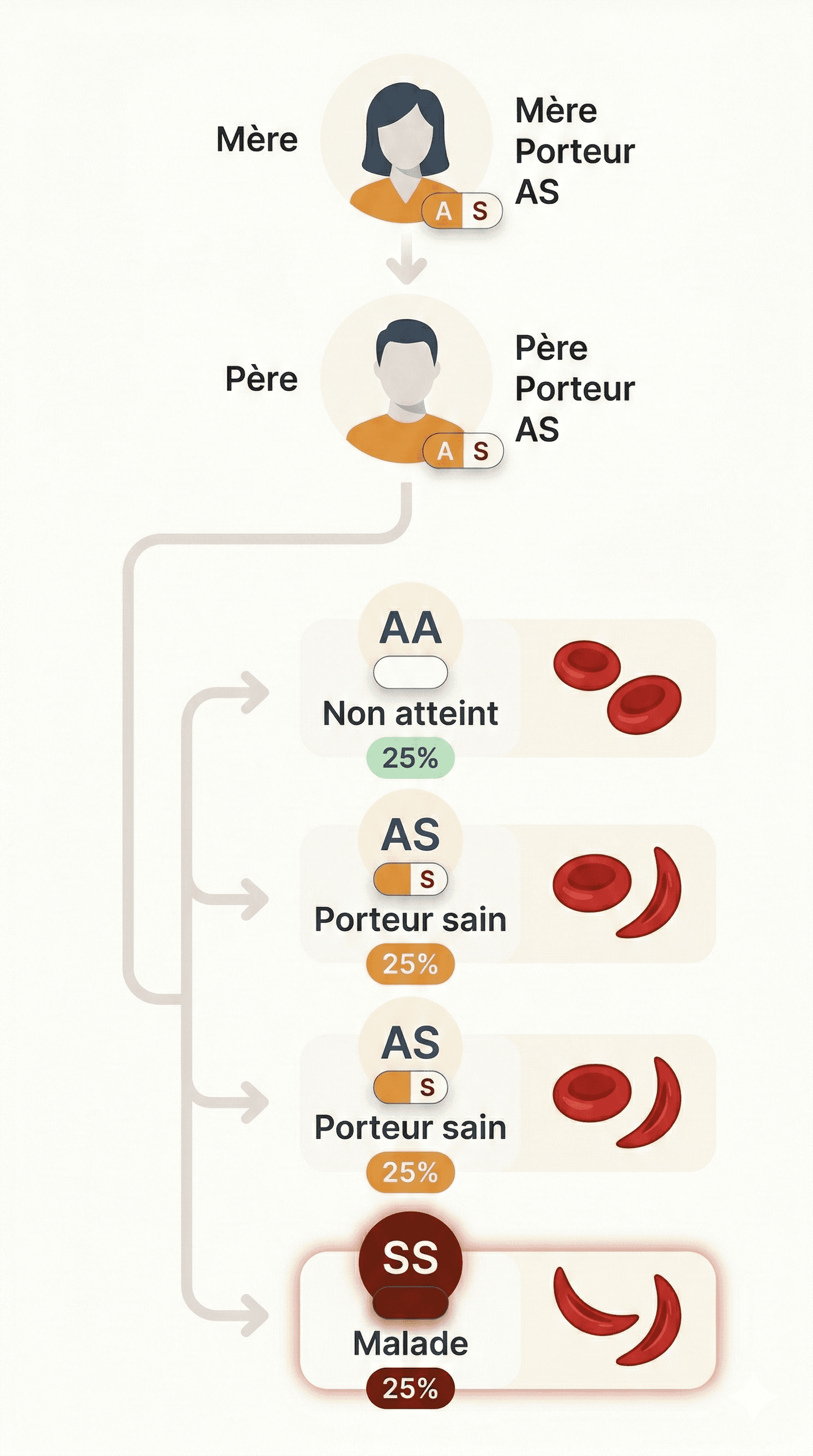 Schéma de transmission génétique de la drépanocytose : deux parents porteurs AS peuvent avoir un enfant non atteint (AA, 25%), deux enfants porteurs sains (AS, 25% chacun) ou un enfant malade (SS, 25%)